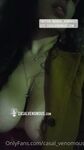 Onlyfans Leaked Photos - Venomouslips - Amateur Photos