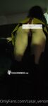 Onlyfans Leaked Photos - Venomouslips - Amateur Photos